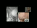 video pic